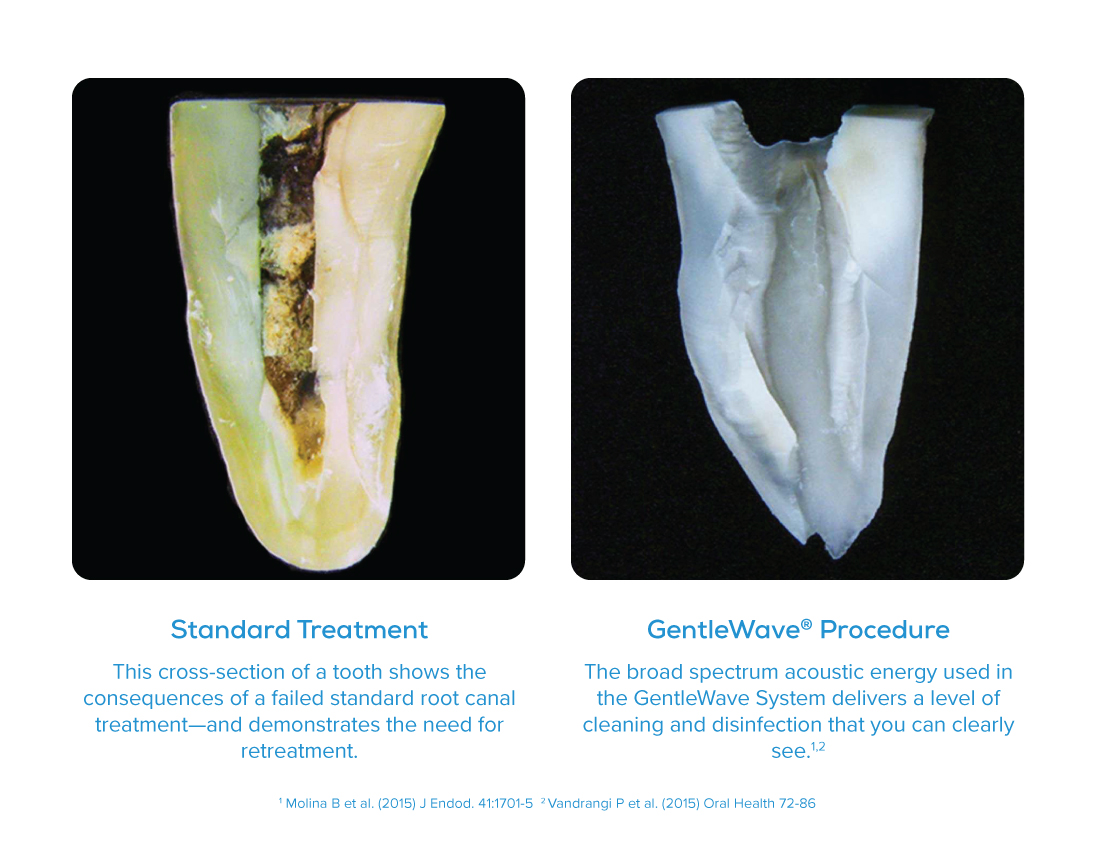 Steamboat Springs Endodontist with GentleWave console